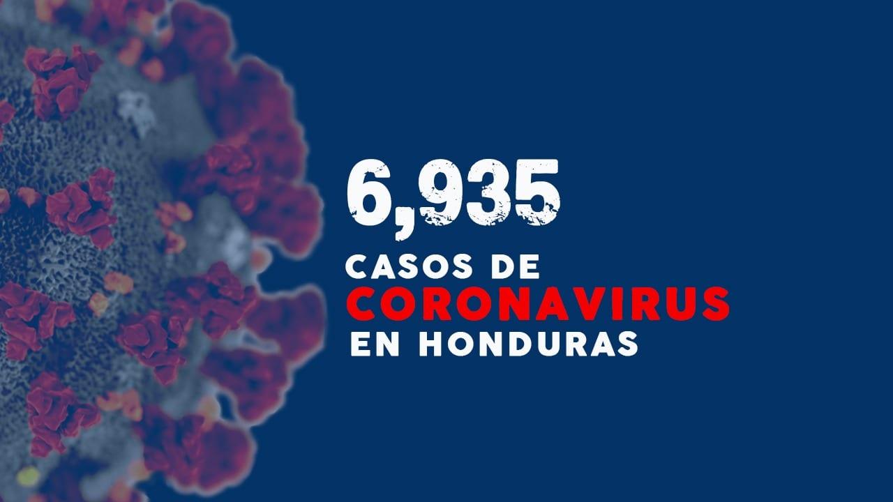 Imagen Principal de Nota: Coronavirus: Sinager reporta 485 nuevos casos que suben la cifra a 6,935 infectados  en Honduras
