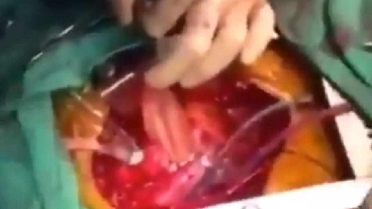 Imagen de En pleno sismo en México, médico realizó cirugía de corazón mientras rezaba