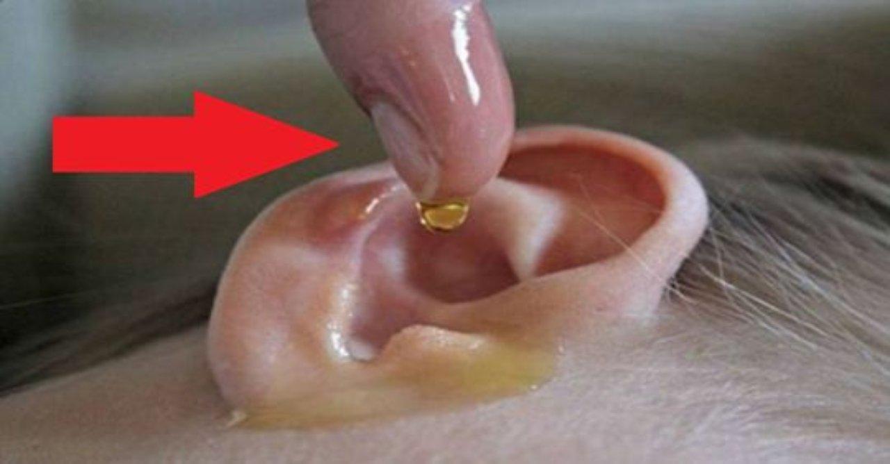 Imagen de Conoce la manera correcta de destapar tus oídos sin lastimarte