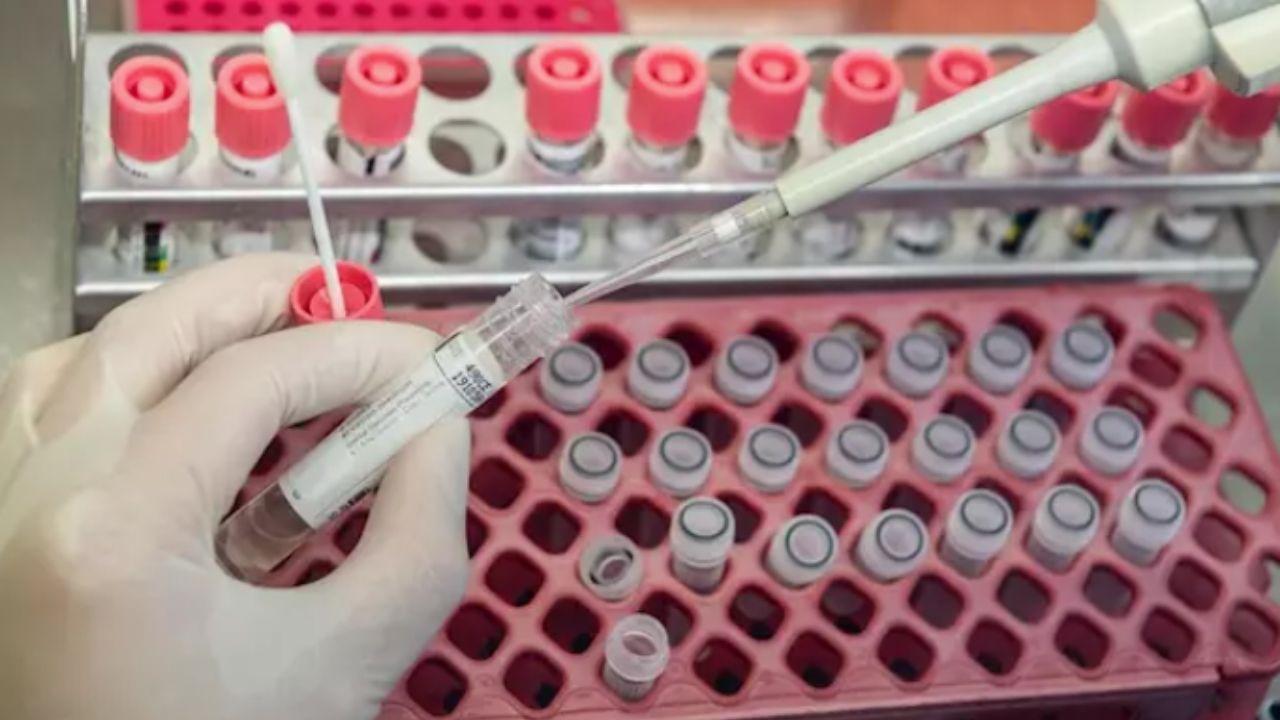 Imagen de Crean cóctel de doble anticuerpo que podría prevenir y tratar la infección por covid-19