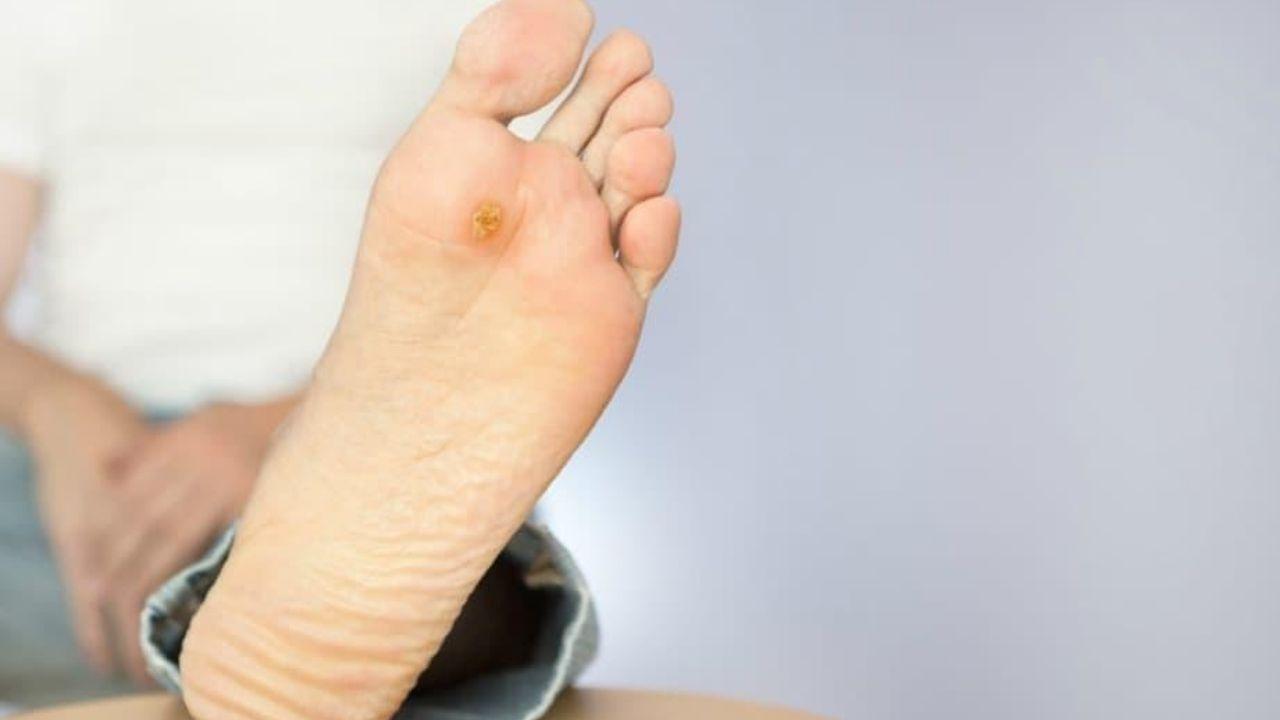 Imagen de Médicos inventan zapatos refrigerantes para la prevención del pie diabético