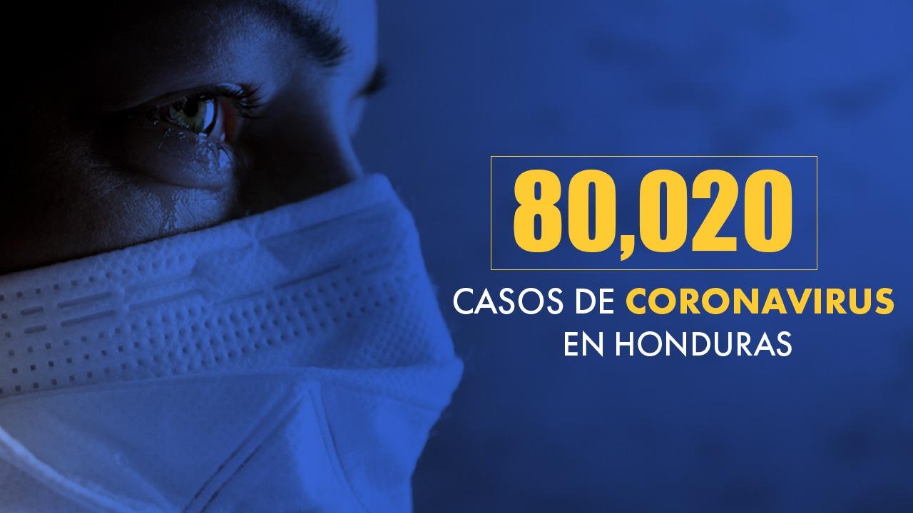 Imagen de Honduras llega a 80,020 casos tras confirmarse 391 nuevas infecciones de covid