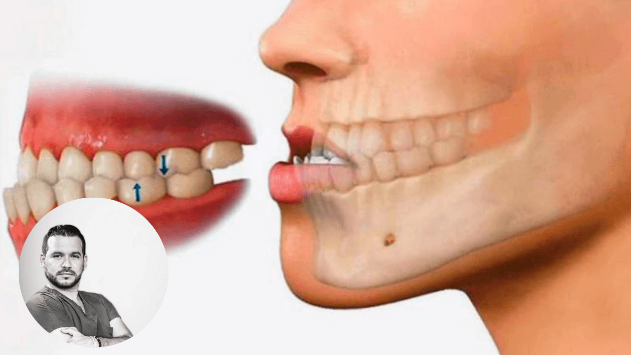 Imagen Principal de Nota: Las Mañanas del 5: ¿Cuáles son los tipos incorrectos de mordida?, el dentista del rock lo explica