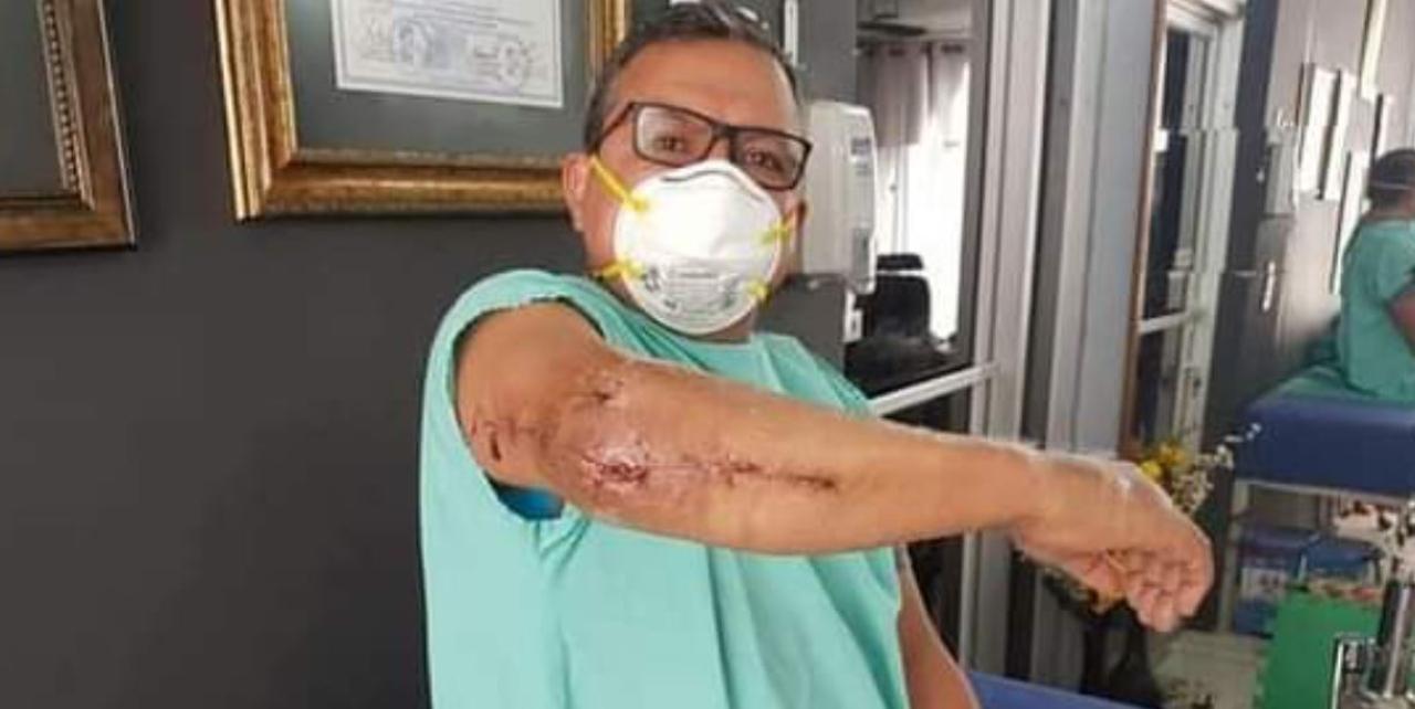 Imagen Principal de Nota: Periodista hondureño pide ayuda para salvar su brazo, tras haber sufrido un atentado mientras cubría una noticia
