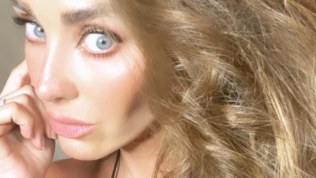 Imagen Principal de Nota: Anahí fue víctima de burlas  en el lugar donde trabajó por haber sido anoréxica