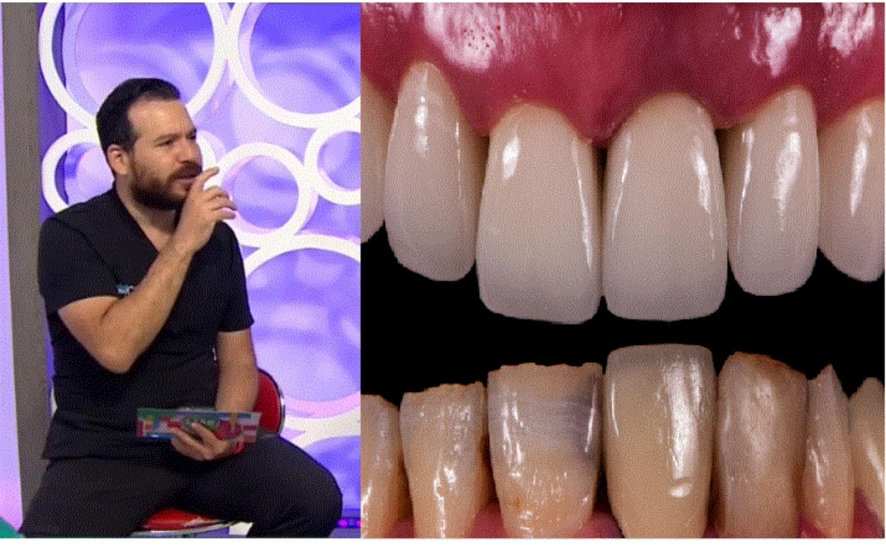Imagen Principal de Nota: ¿Los problemas dentales pueden provocar otras enfermedades? El doctor Tito Livio lo explica
