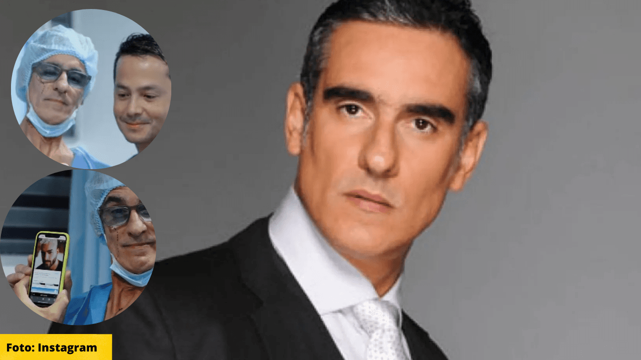 Imagen de Miguel Varoni sorprende a seguidores al anunciar su  'transformación' de la mano de un reconocido cirujano plástico