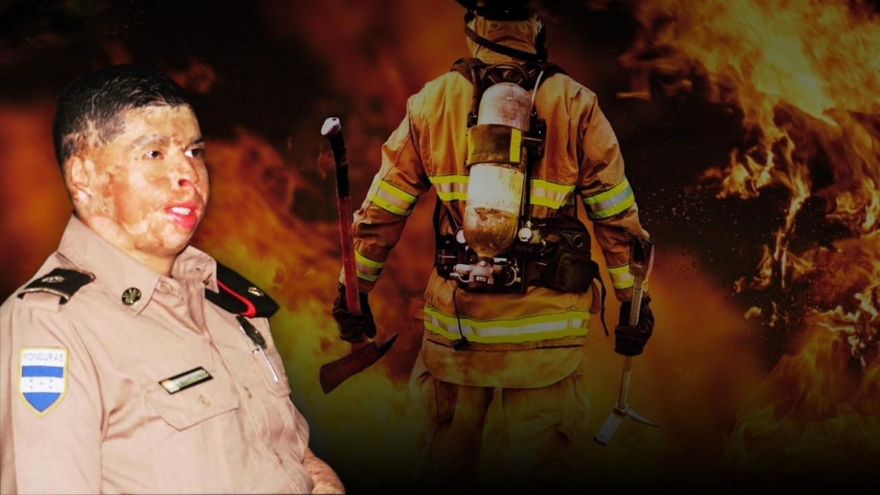 Imagen Principal de Nota: El bombero hondureño Ever Velásquez recuerda con nostalgia otro año del incendio que le desfiguró su rostro