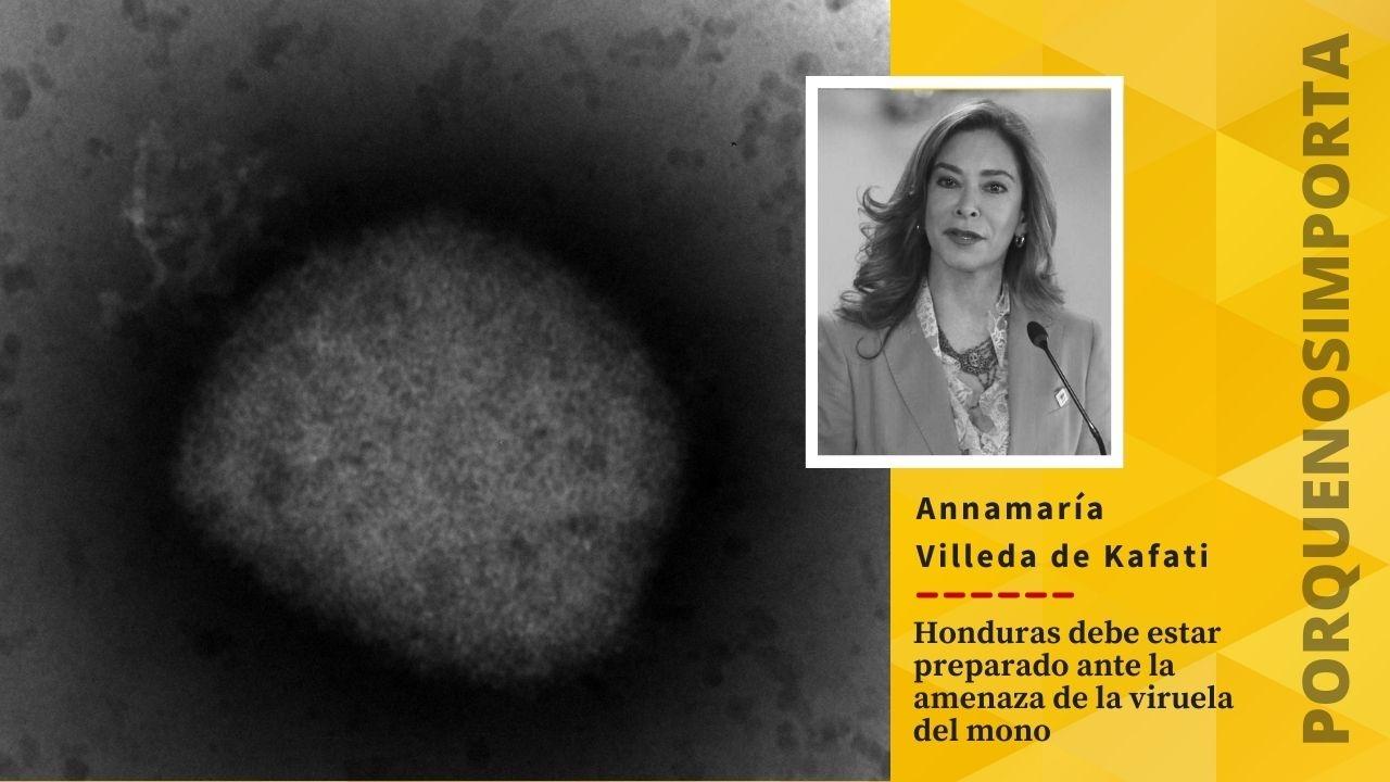 Imagen de Porque Nos Importa: La viruela del mono amenaza a Honduras en medio de brote de enfermedades endémicas