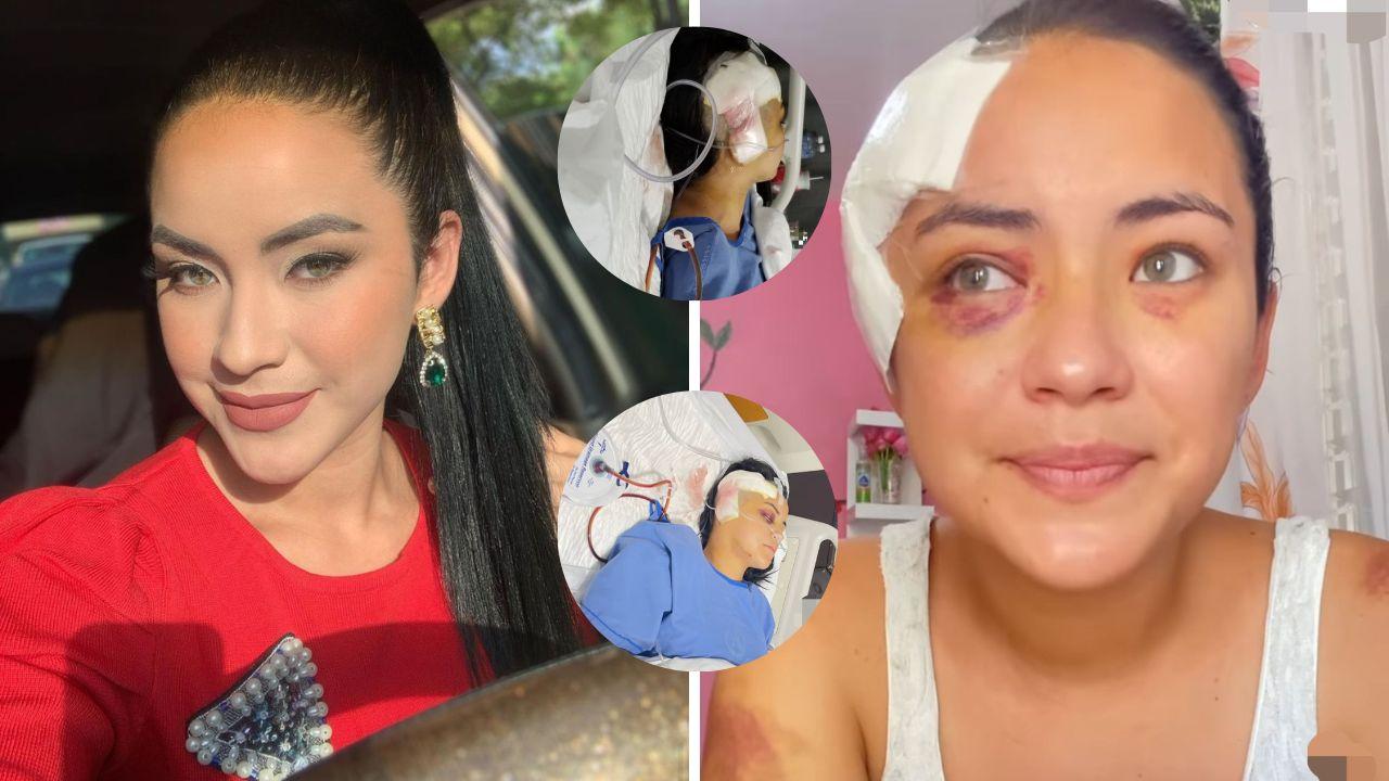Imagen Principal de Nota: Modelo hondureña, Iris Portillo, reaparece en redes tras sufrir accidente