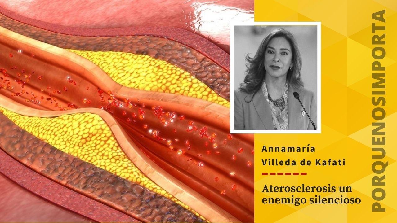 Imagen de Porque Nos Importa: La aterosclerosis, un enemigo silencioso