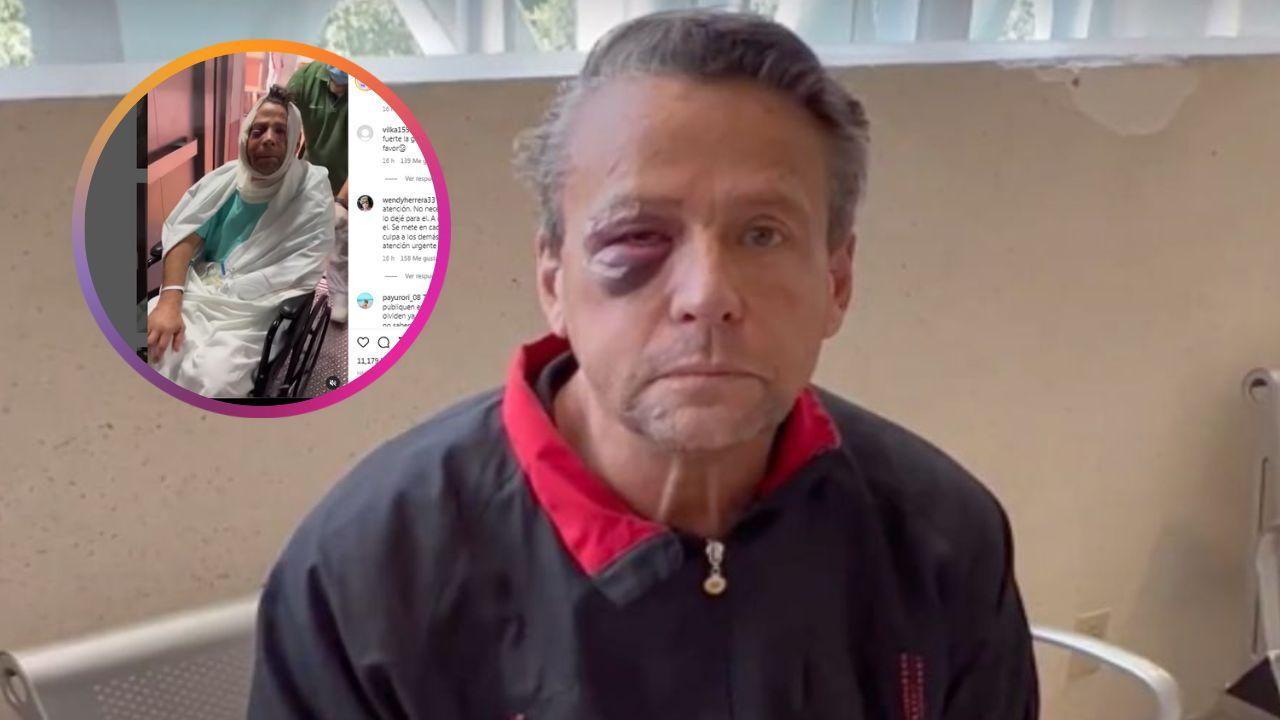 Imagen de Impactantes imágenes de Alfredo Aldame al salir del hospital tras ser operado de emergencia