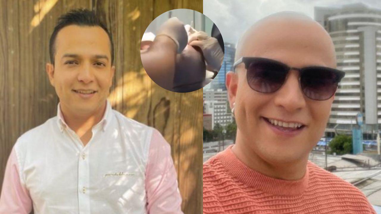 Imagen Principal de Nota: ¡Fotos! Erik Chavarría se somete a tratamiento estético para erradicar la calvicie