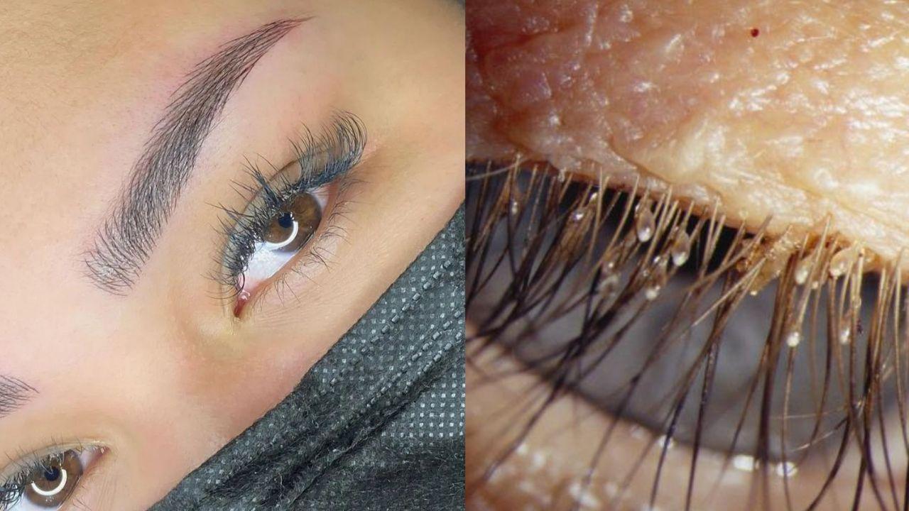 Imagen de Médicos alertan a hondureñas sobre riesgo de piojos en extensiones de pestañas