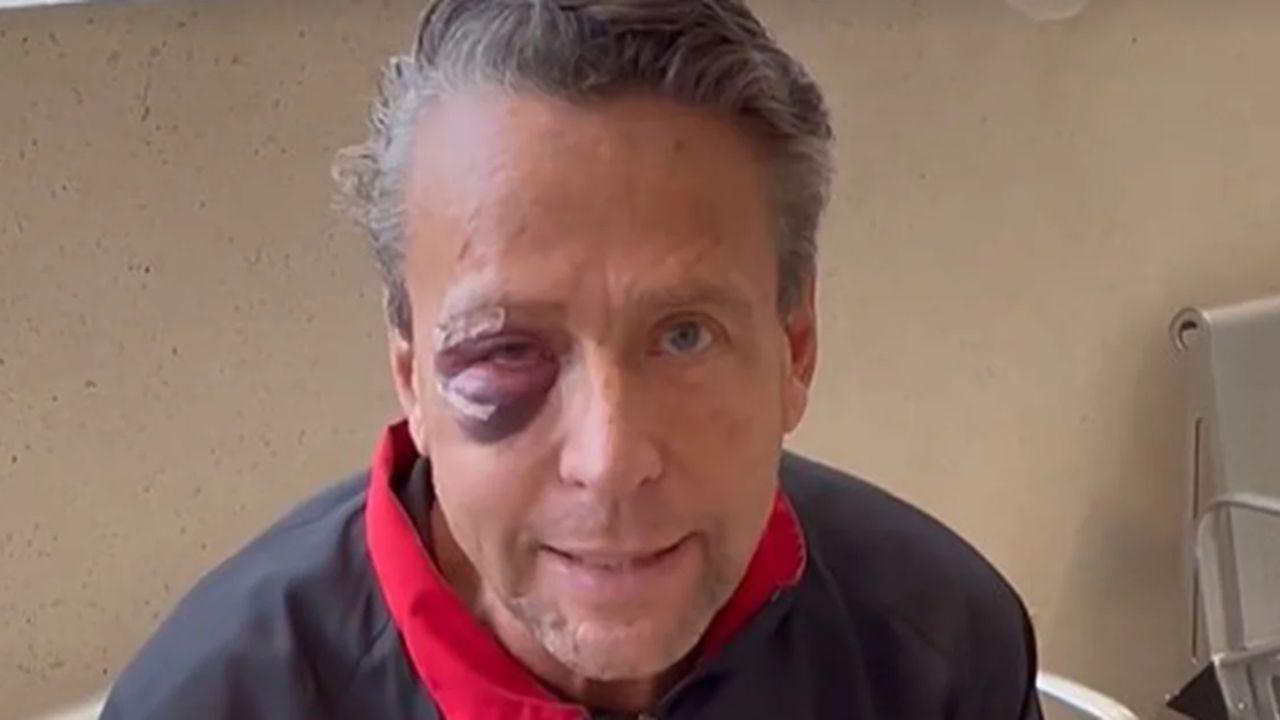 Imagen de Alfredo Adame revela sentir miedo después de fuerte golpiza