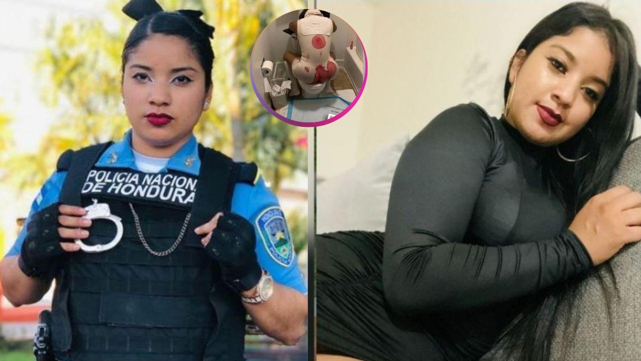 Imagen de La impactante imagen que compartió la expolicia hondureña   Génesis Alvarado tras salir del quirófano
