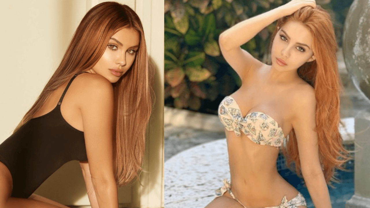 Imagen Principal de Nota: Alexa Dellanos se somete a nueva cirugía estética y muestra sus resultados
