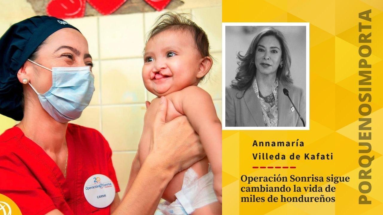 Imagen Principal de Nota: Porque Nos Importa: Operación Sonrisa sigue cambiando la vida de miles de hondureños