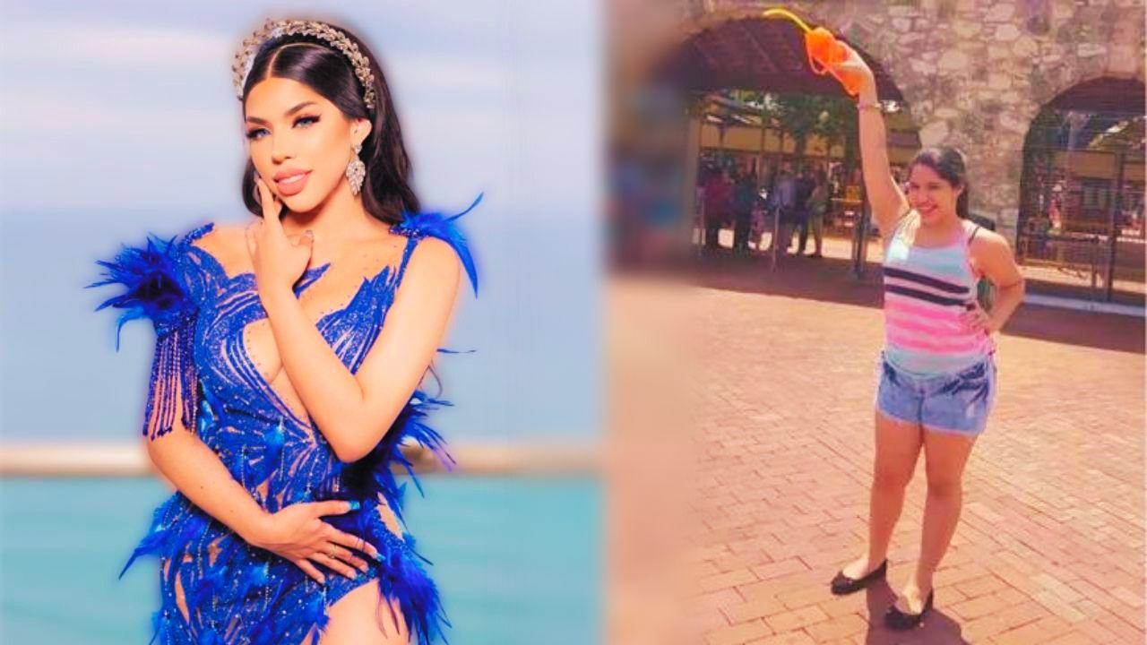 Imagen Principal de Nota: Antes y después: así lucía Yeri Mua sin cirugías estéticas