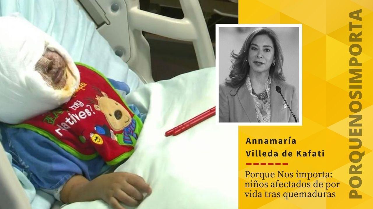Imagen Principal de Nota: Porque Nos importa: niños afectados de por vida tras quemaduras