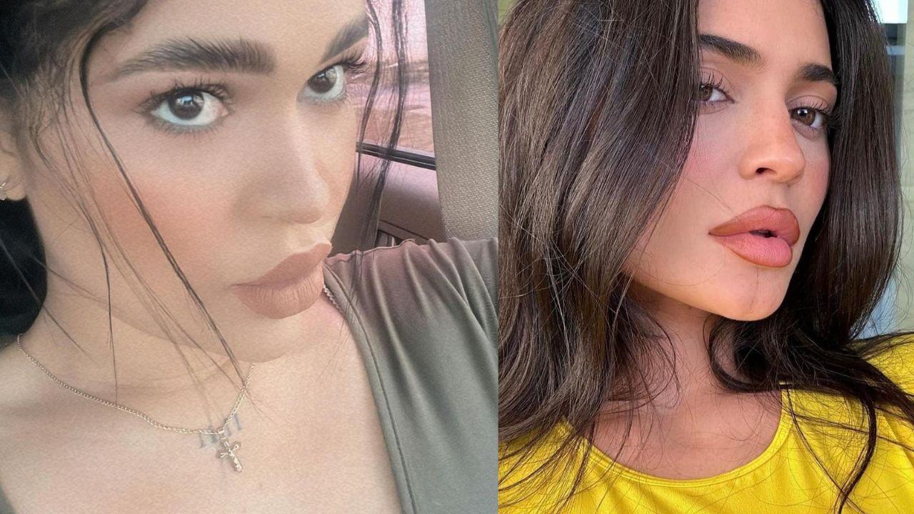 Imagen Principal de Nota: 'Juanchi' sorprende con su radical cambio de imagen al lucir idéntica a Kylie Jenner ¿Tiene cirugías?