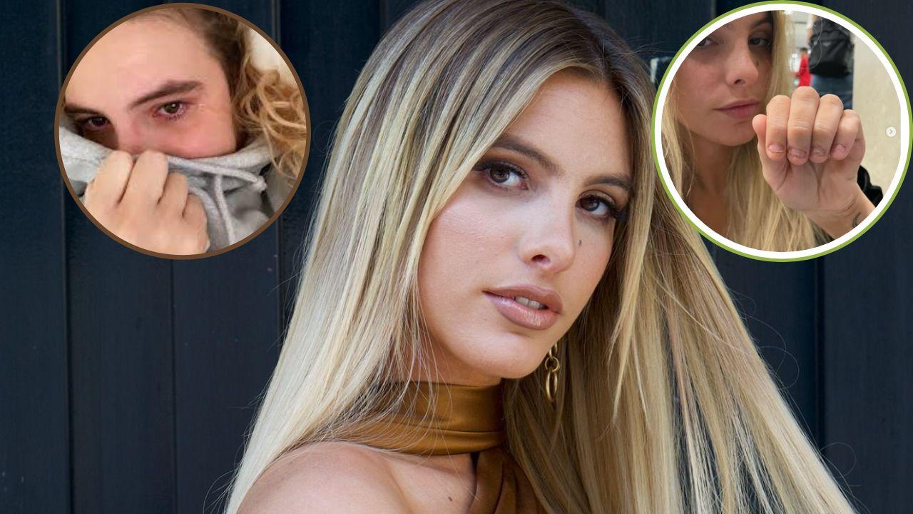 Imagen Principal de Nota: Lele Pons revela los daños que ha causado en su cuerpo la ansiedad