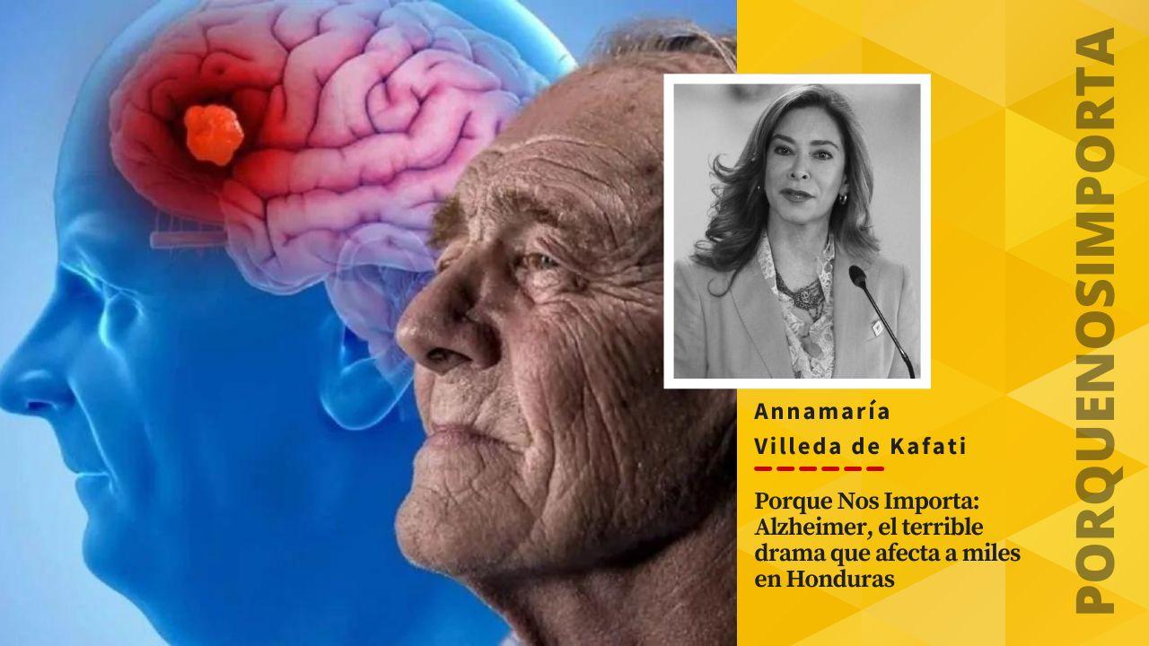 Imagen Principal de Nota: Porque Nos Importa: Alzheimer, el terrible drama que afecta a miles en Honduras