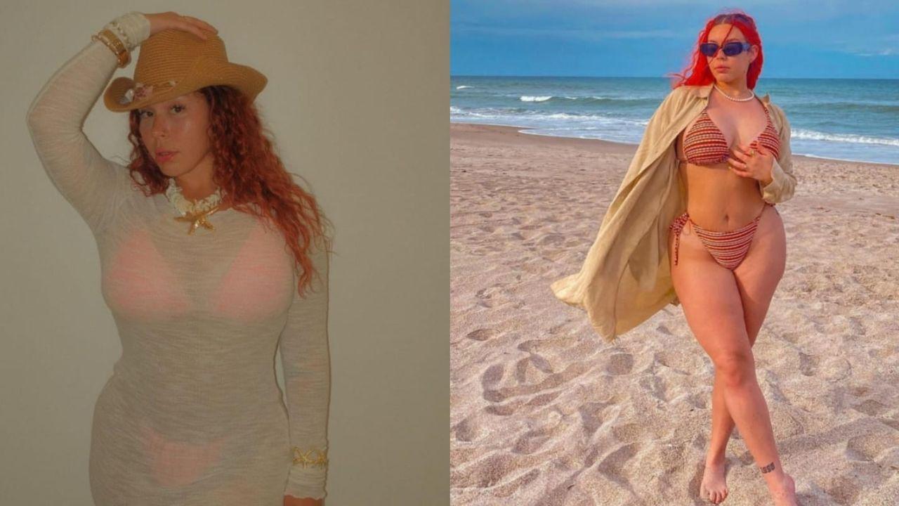 Imagen Principal de Nota: Hija de Daddy Yankee con problemas de psoriasis al lavarse el cabello