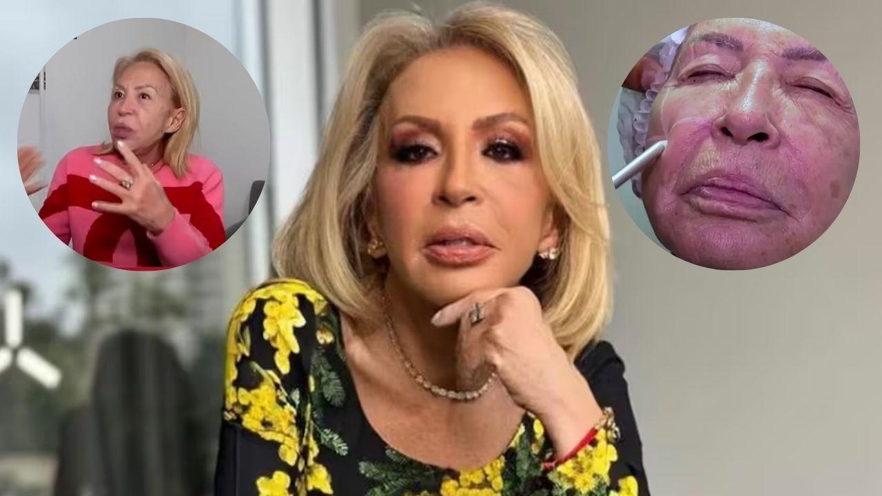 Imagen Principal de Nota: Laura Bozzo revela su transformación  de rostro tras procedimiento estético en Perú