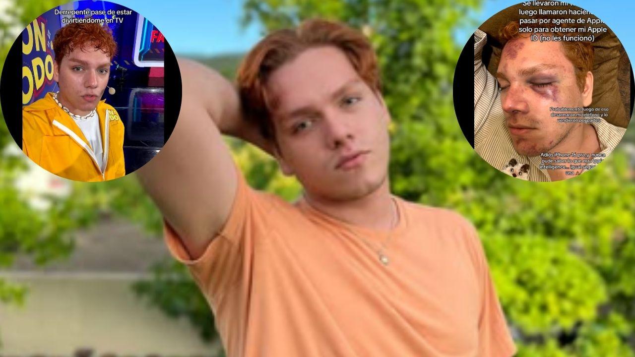 Imagen Principal de Nota: Influencer hondureño Patrick Nelson denuncia brutal agresión y despido tras ataque
