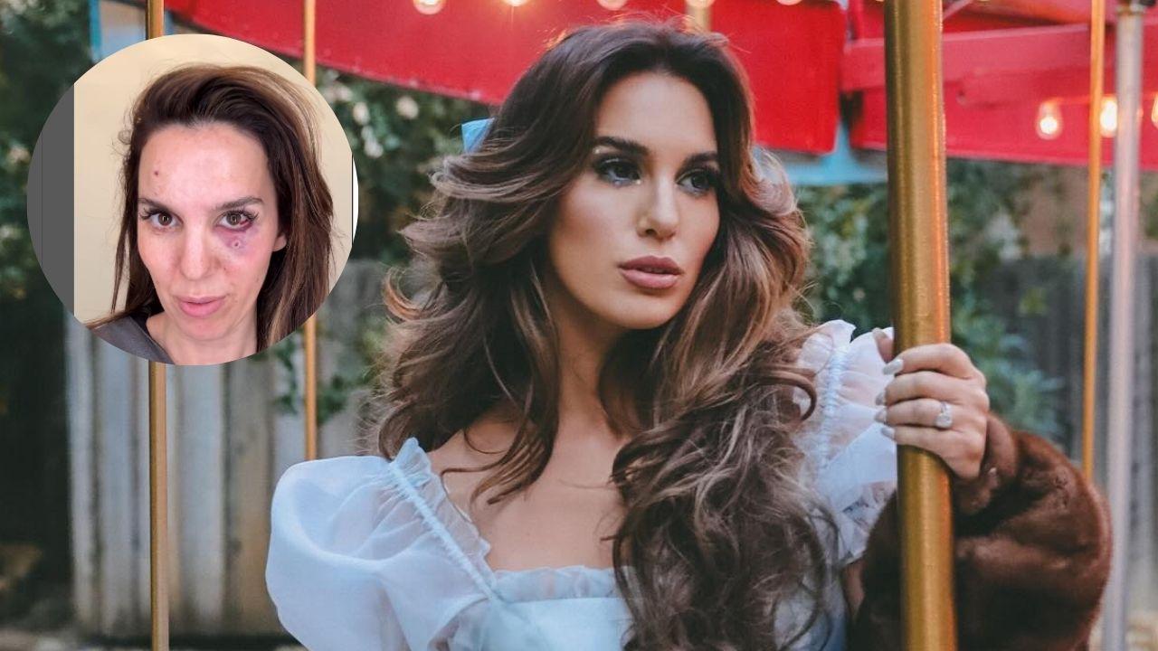 Imagen Principal de Nota: Actriz de Disney Channel recibe un disparo en la cara durante celebración de cumpleaños de su esposo