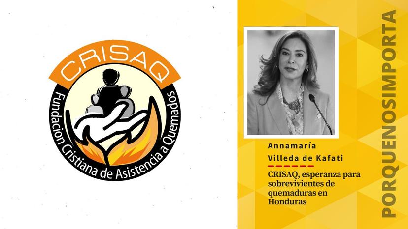 CRISAQ, esperanza para sobrevivientes de quemaduras en Honduras