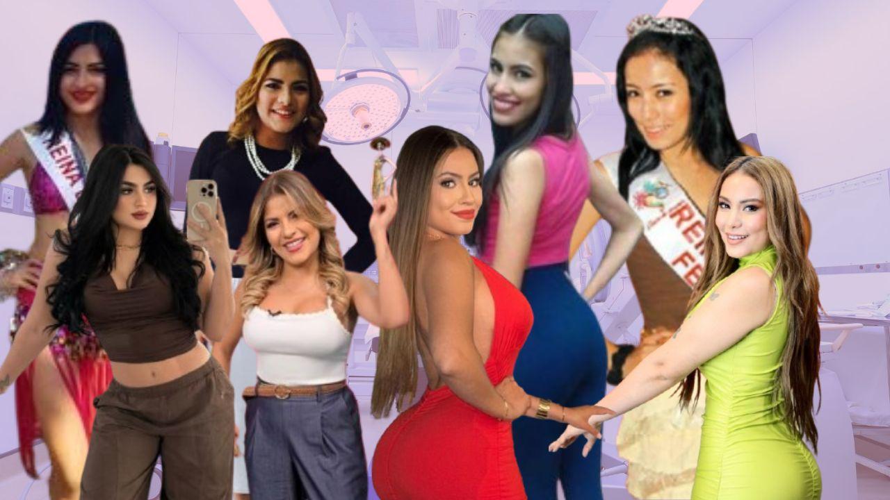 Imagen de Hondureñas famosas que han apostado por las cirugías estéticas para transformar su imagen