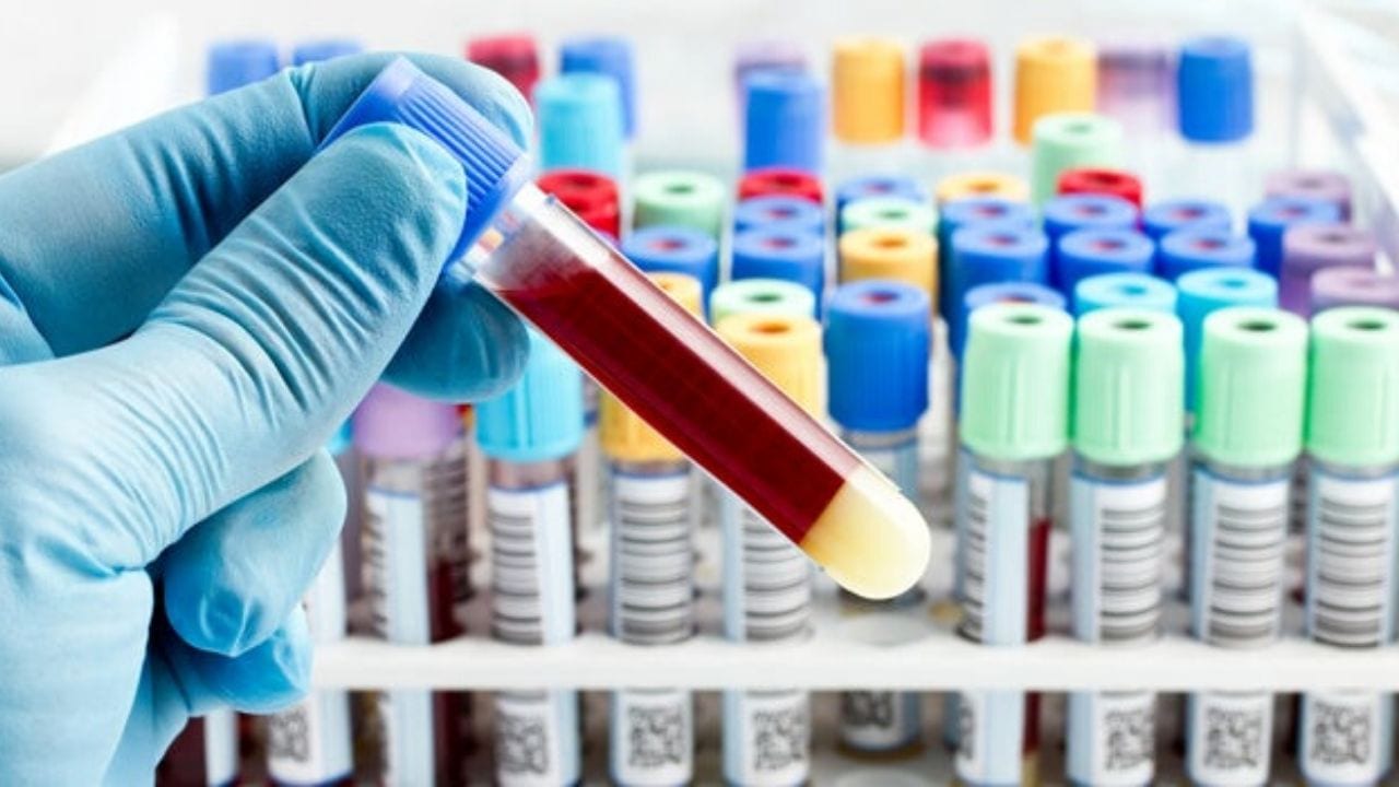 Imagen Principal de Nota: Este tipo de sangre presenta un mayor riesgo de infectarse de coronavirus según estudio
