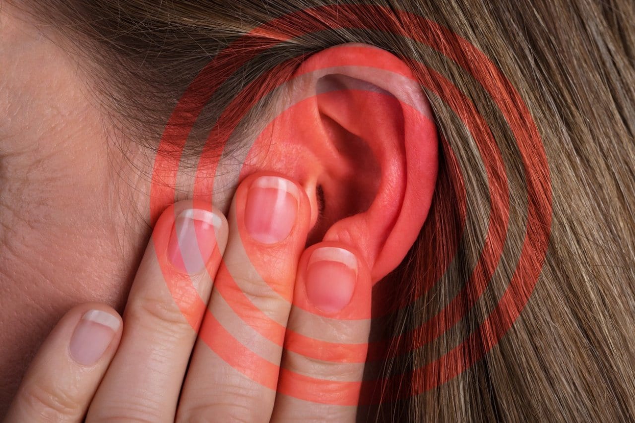 Imagen de ¿Sufres de zumbido constante en los oídos? Cuidado, podrías padecer de tinnitus