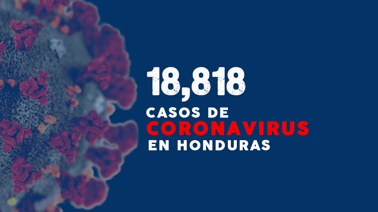 Imagen Principal de Nota: Coronavirus: Honduras registra 736 nuevos casos y la cifra asciende a 18,818