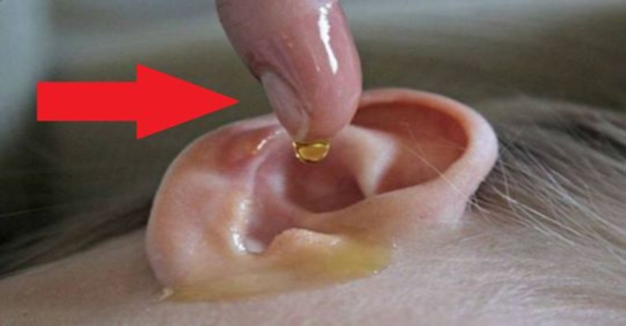 Imagen de Conoce la manera correcta de destapar tus oídos sin lastimarte