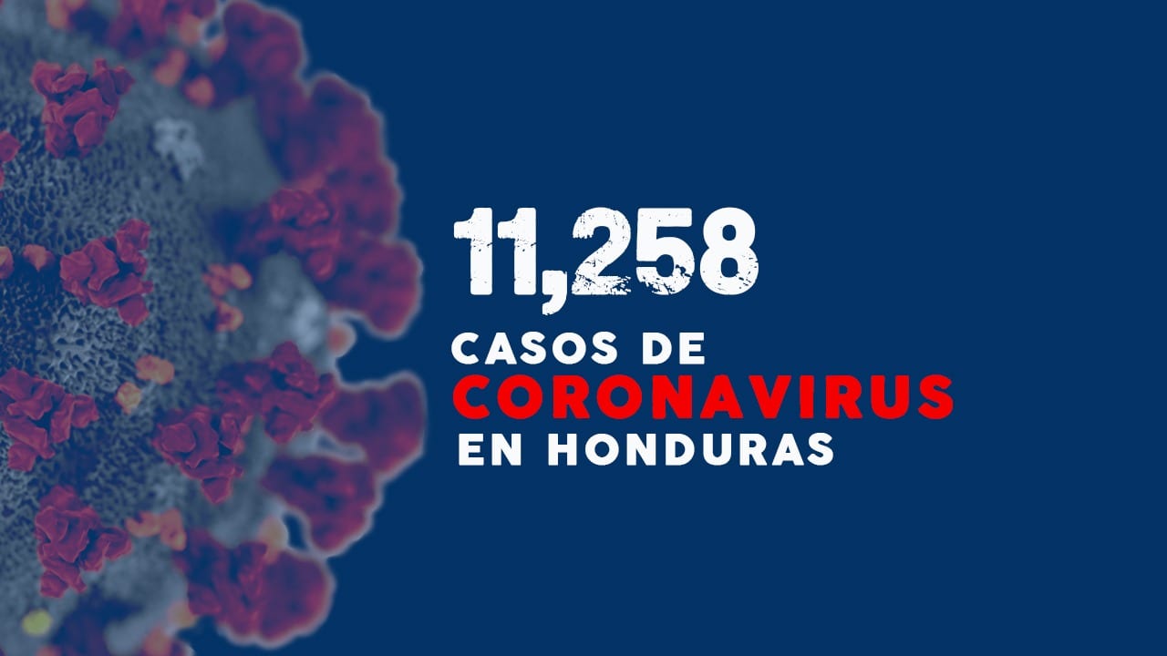 Imagen Principal de Nota: Honduras supera los 11 mil casos y 349 muertes por covid-19