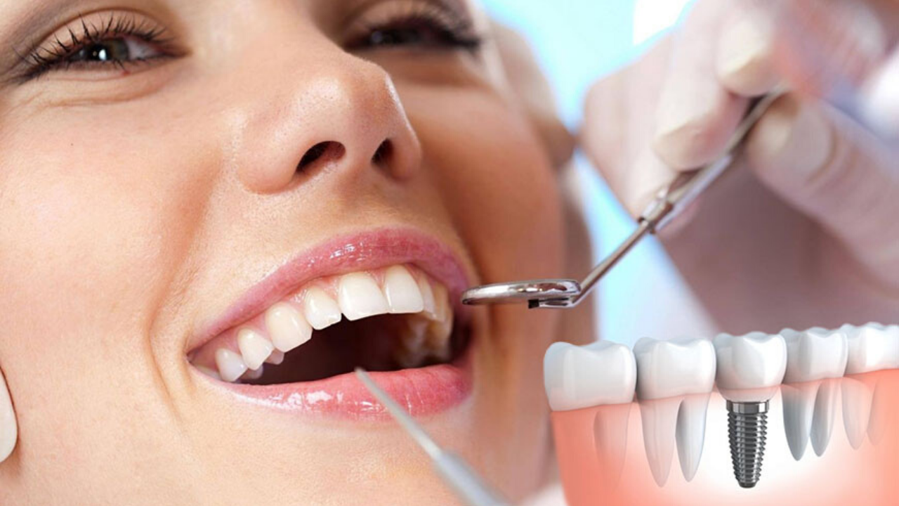 Imagen Principal de Nota: Las Mañanas del 5: Antes de ponerte un puente o implante dental, esto es lo que debes saber