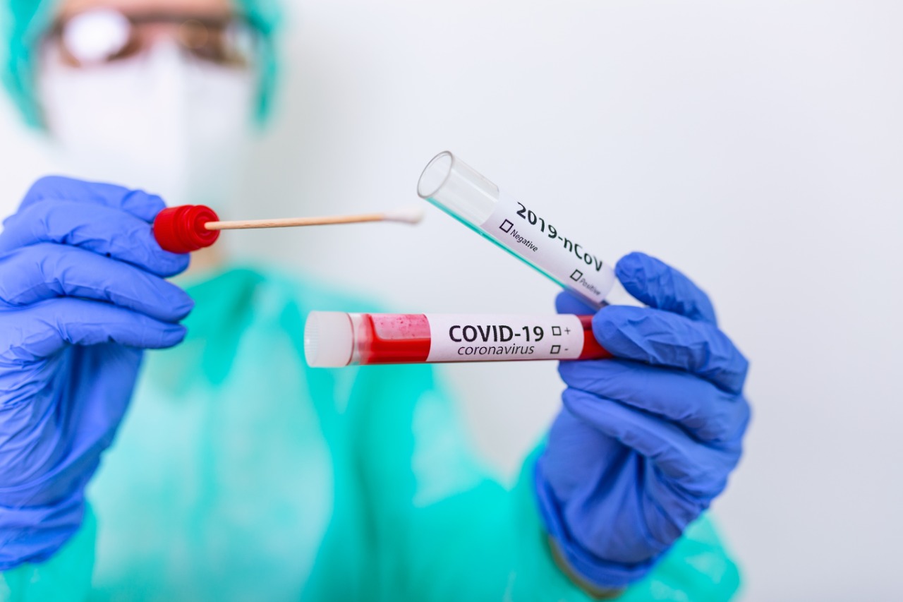 Imagen Principal de Nota: Coronavirus: Hasta la otra semana llegarán reactivos para pruebas covid-19, según Metropolitana de Salud