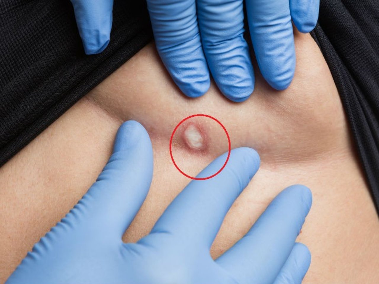 Imagen Principal de Nota: Surgen nuevos síntomas de cáncer de mama que no tienen nada que ver con sentir un 'bulto' en el seno