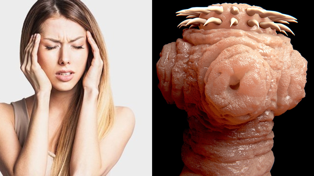 Imagen Principal de Nota: Cuándo un dolor de cabeza podría ser una señal de un parásito en el cerebro
