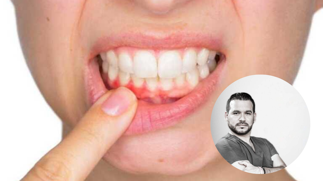 Imagen de Las Mañanas del 5: ¿Qué hacer si tienes un diente con infección? El Dentista del Rock lo explica