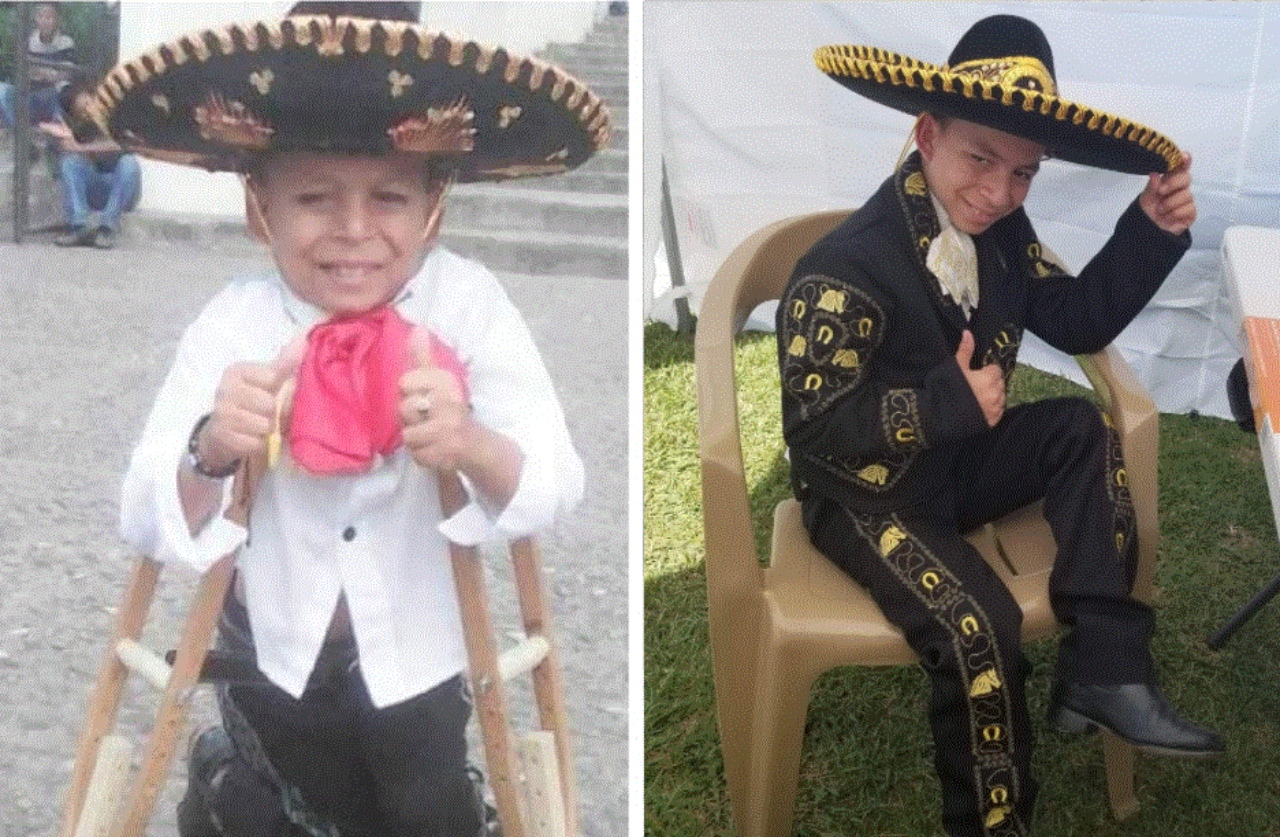 Imagen Principal de Nota: Marlon Yasir 'El niño de oro' ya puede caminar tras más de 24 cirugías y así se mostró con sus seguidores