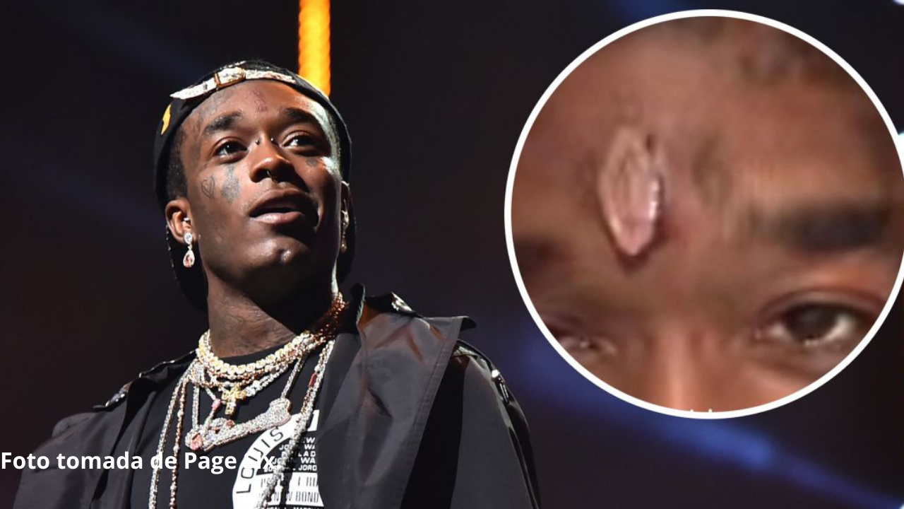 Imagen de Roban al rapero Lil Uzi Vert un diamante que tenía incrustado en su frente valorado en $24 millones