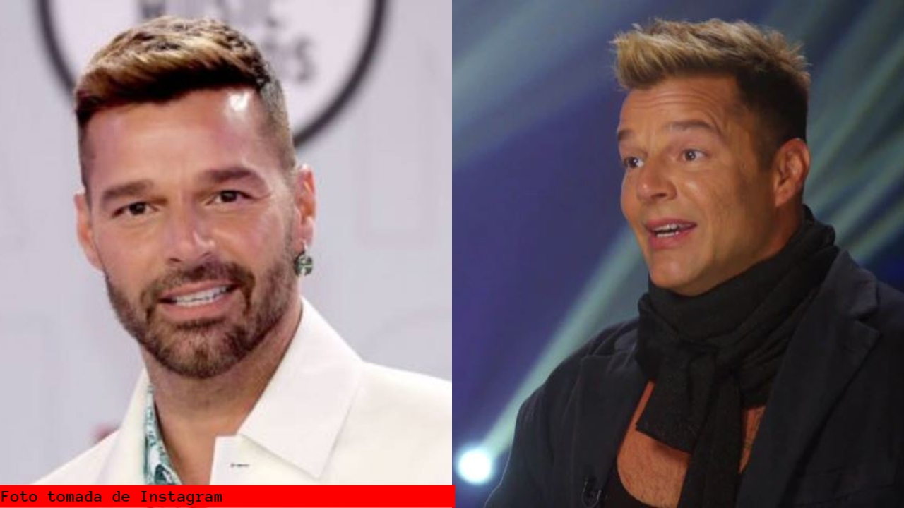 Imagen Principal de Nota: ¡Ricky Martin da la cara! Con este vídeo explicó qué le pasó en el rostro, ¿se hizo cirugía?