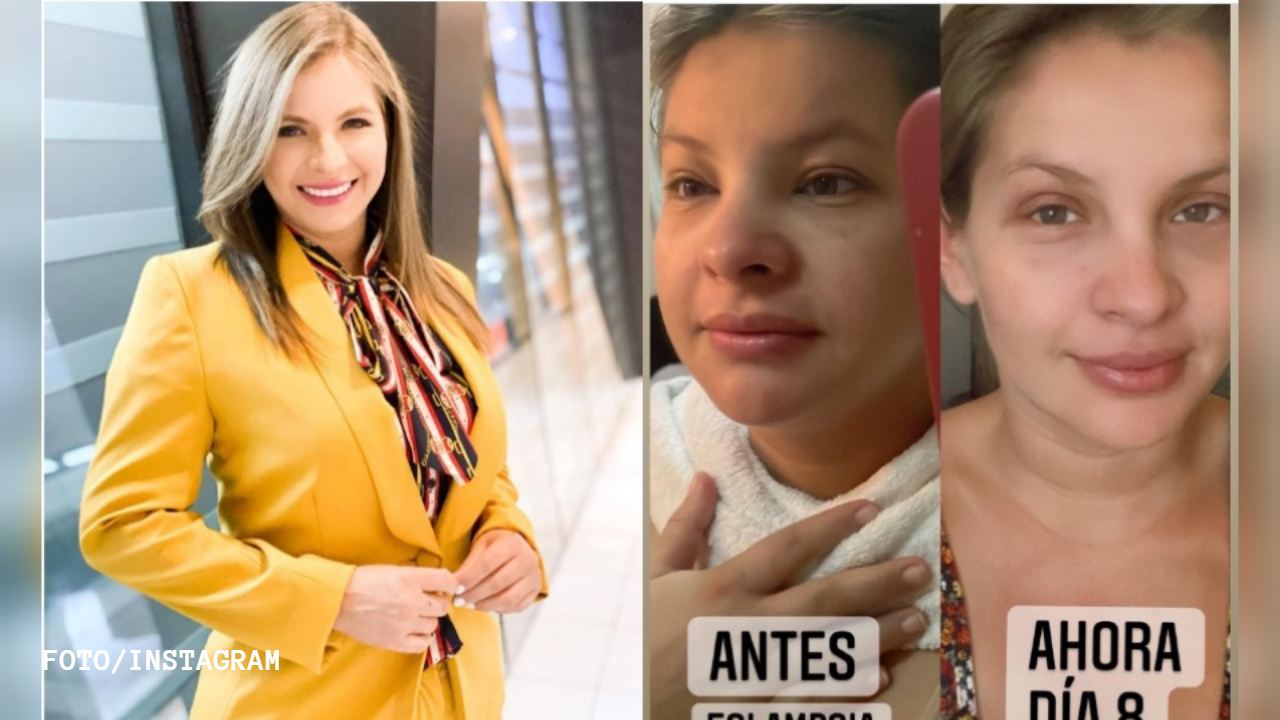 Imagen de Cristina Rodríguez comparte impactantes imágenes de los estragos de la eclampsia, que provocó la interrupción de su embarazo