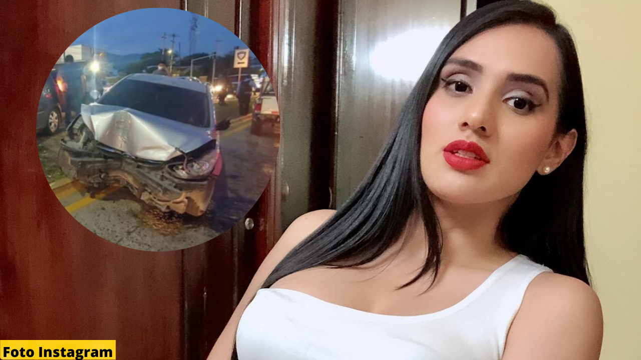 Imagen de La hondueña Riccy  Moreno rompe el silencio y aclara qué fue lo que pasó con el atentado que sufrió