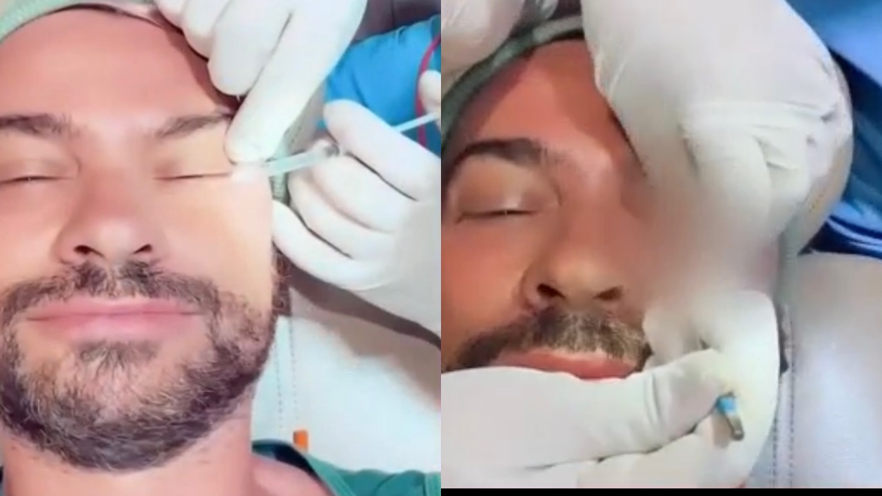 Imagen de Actor quedó ciego tras someterse a cirugía estética y envía conmovedora reflexión