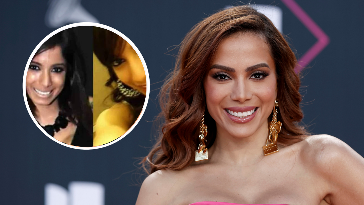 Imagen de Irreconocible: Anitta revela cuantas cirugías plásticas se ha realizado para verse esbelta